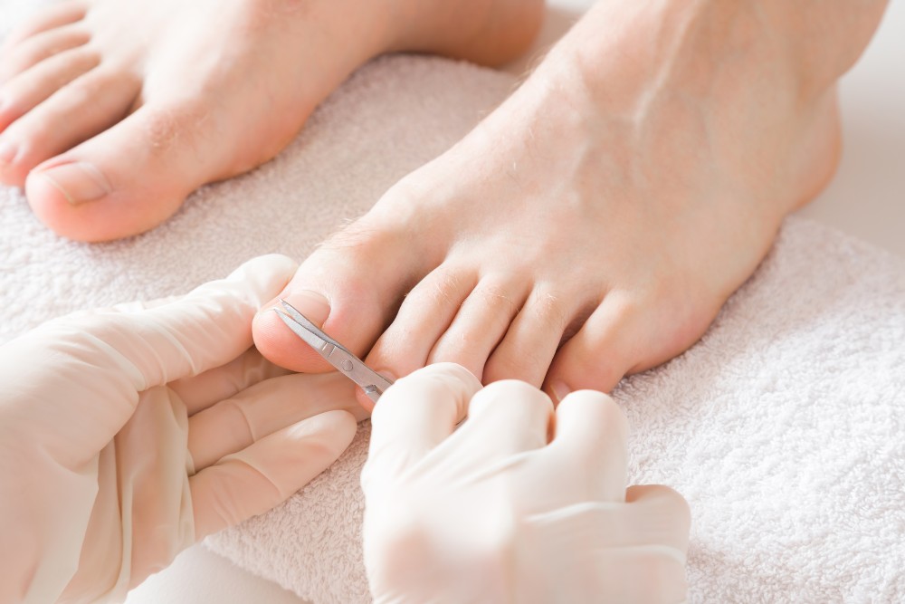Podiatrist treating ingrown toenails