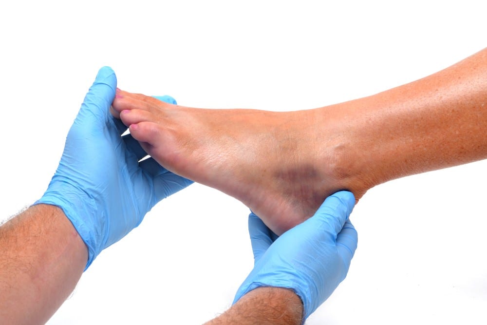 Doctor examining foot for athlete's foot infection