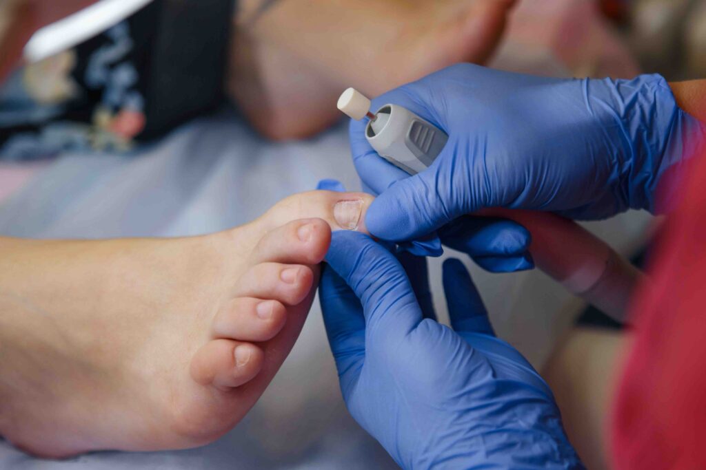 Reoccurring Ingrown Toenails? Here’s What You Should Do! Premier